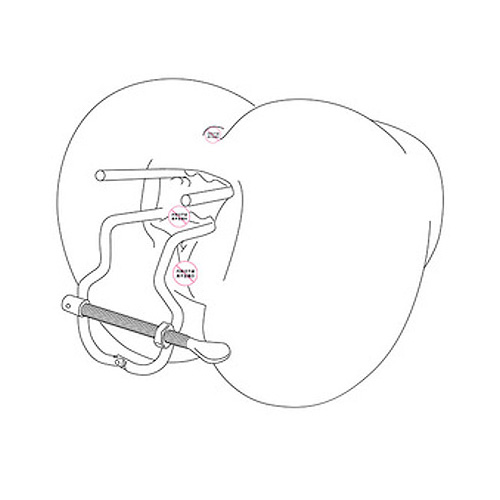 スチールロッドスペキュラム画像7