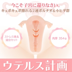 ウテルス計画